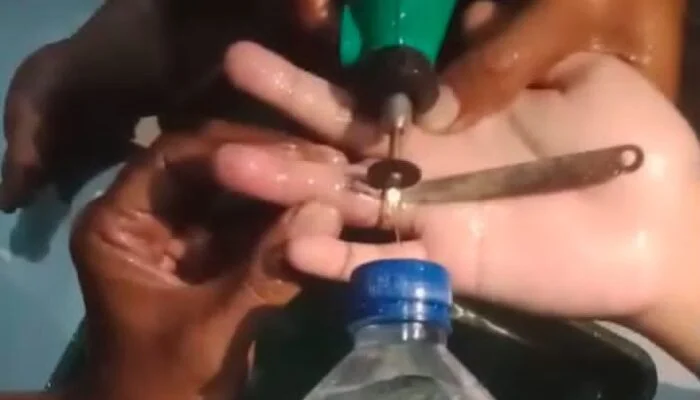 Gerak Cepat Damkar Jepara Lepaskan Cincin Tersangkut Pakai Alat Pemotong Khusus
