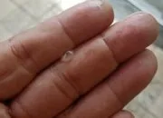 Viral di Medsos, Hujan Es dan Angin Kencang Terjang Mojosongo Solo